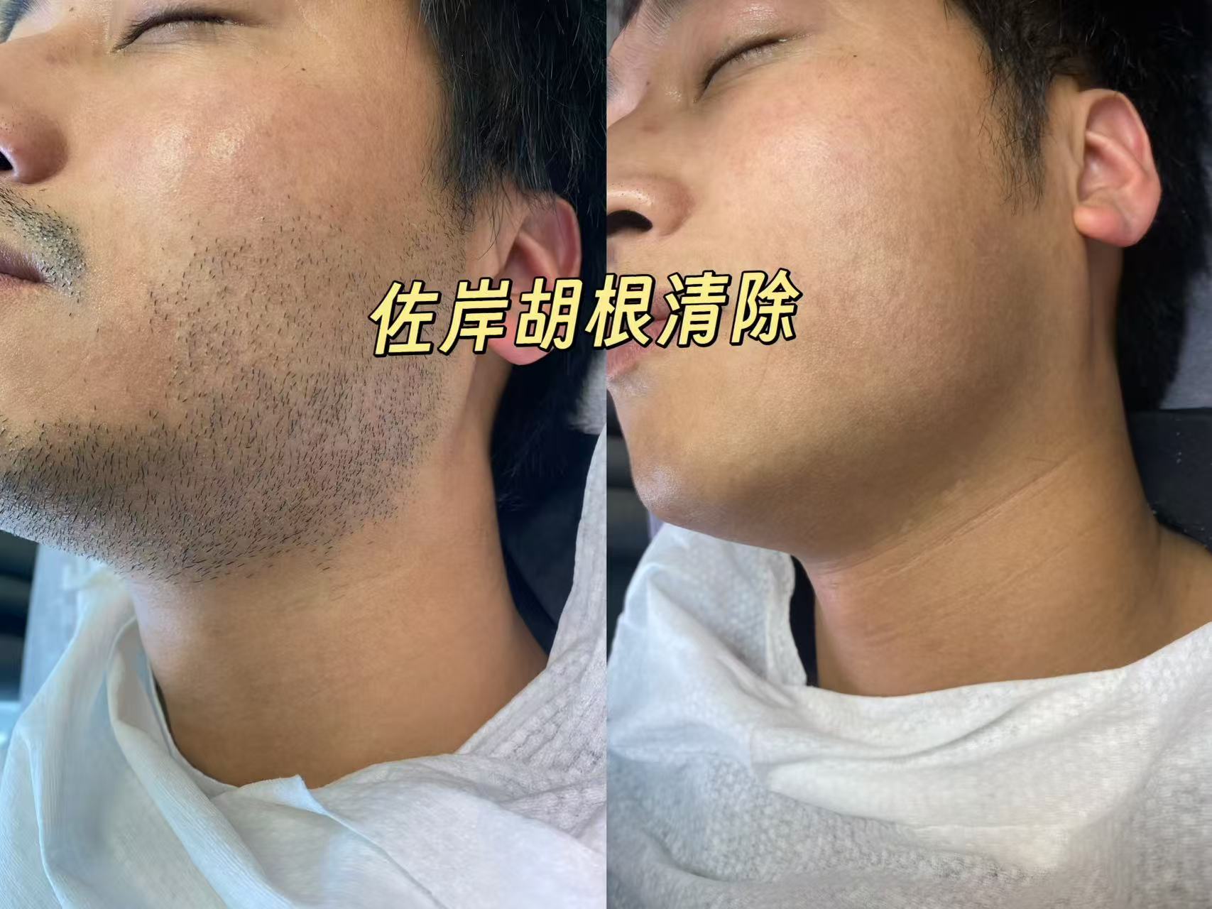 绍兴脱胡子